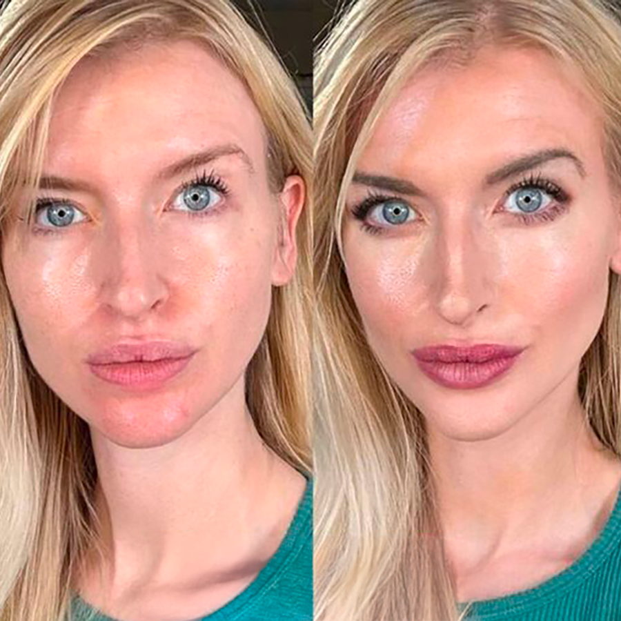 Kehyla - All in one essential set