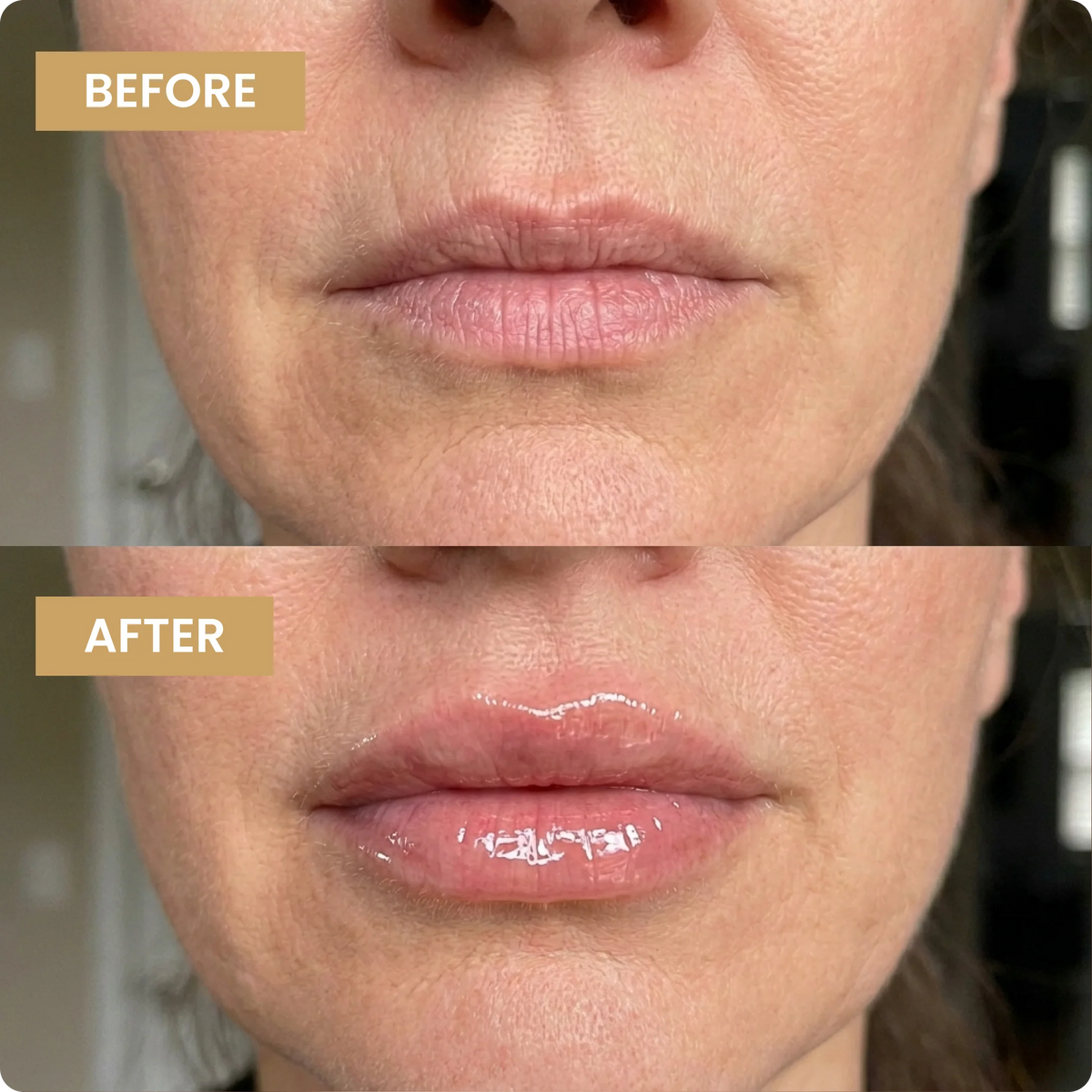 Kehyla Beauty - Voluminizador de labios