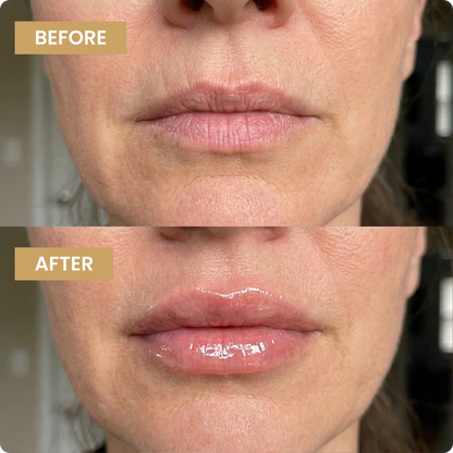 Kehyla Beauty - Voluminizador de labios